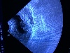  - Gestation de 6 chiots confirmée par échographie